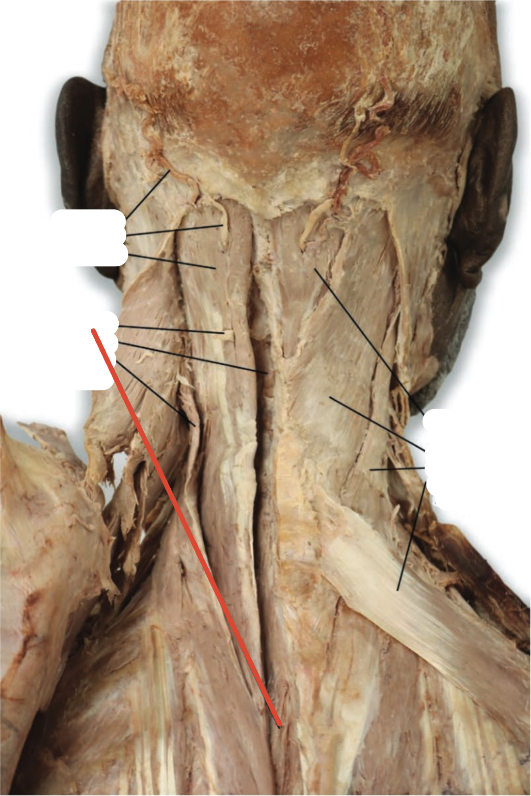 Identify the structure (red line)