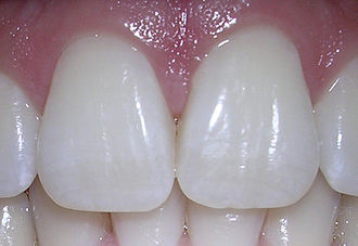 <p>The sharp-edged teeth at the front of the mouth used for cutting food.</p>