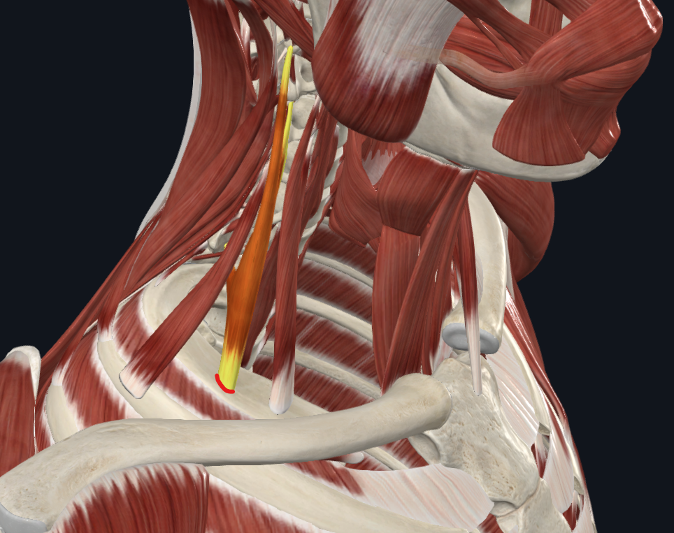 <p><strong>Nombre alterno: X</strong></p><p><strong><mark data-color="yellow" style="background-color: yellow; color: inherit">Origen: </mark></strong><mark data-color="yellow" style="background-color: yellow; color: inherit">Tubérculos posteriores de las apófisis transversas de C1-C7</mark></p><p><strong><mark data-color="blue" style="background-color: blue; color: inherit">Inserción: </mark></strong><mark data-color="blue" style="background-color: blue; color: inherit">Cara superior de la primera costilla detrás de la inserción del escaleno anterior</mark></p><p><strong><mark data-color="red" style="background-color: red; color: inherit">Acción:</mark></strong></p><p><mark data-color="red" style="background-color: red; color: inherit">Punto fijo distal: Flexión lateral del cuello</mark></p><p><mark data-color="red" style="background-color: red; color: inherit">Punto fijo proximal: Elevación de la primera costilla</mark></p><p><mark data-color="red" style="background-color: red; color: inherit"><u>Cuanto te da hipo</u></mark></p><p><strong><mark data-color="purple" style="background-color: purple; color: inherit">Inervación: </mark></strong><mark data-color="purple" style="background-color: purple; color: inherit">Nervios cervicales C4-C6</mark><strong><br><mark data-color="green" style="background-color: green; color: inherit">Relaciones: </mark></strong><mark data-color="green" style="background-color: green; color: inherit">Atras nervio frénico, plexo braquial</mark></p><p><strong>Notas:</strong></p><p>Agonista del ECM</p><p>Escaleno más largo</p>