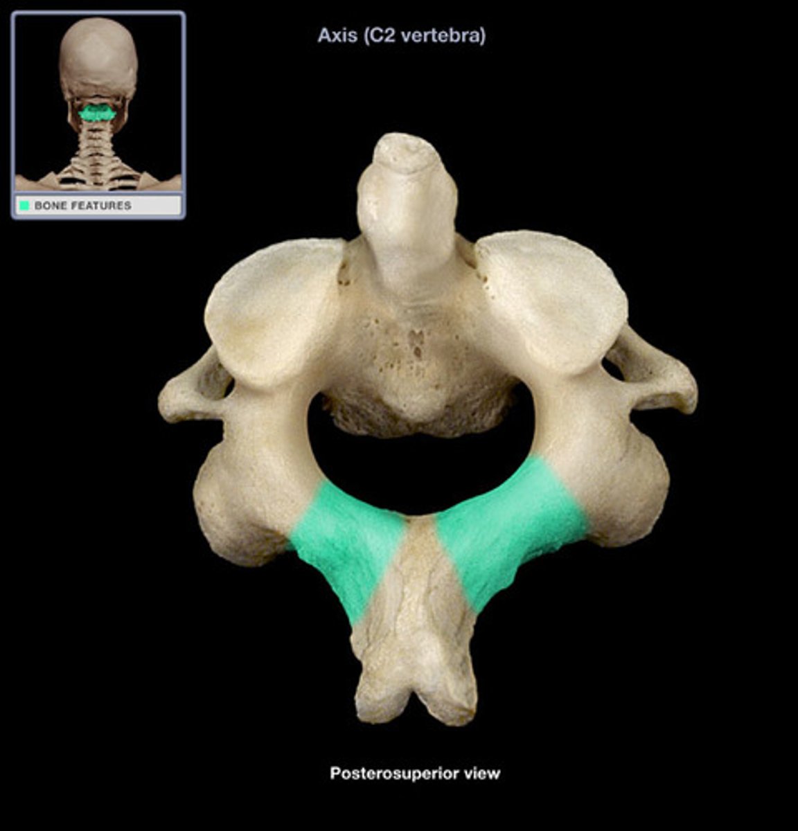 <p>(what vertebra and what structure is highlighted)</p>
