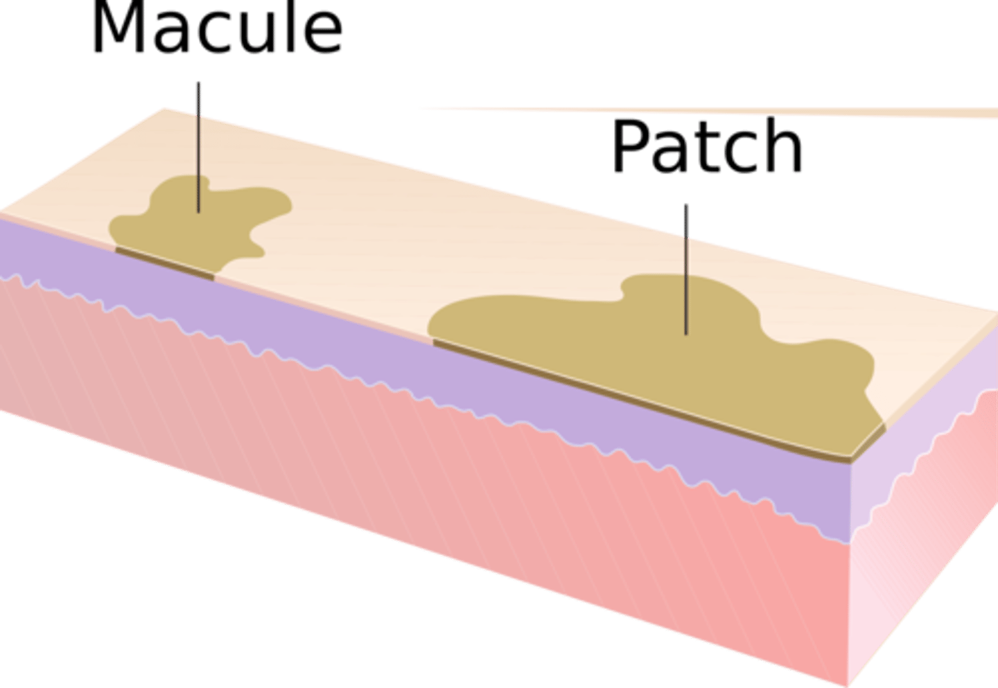 <p>a flat, discolored area on the skin larger than 1 cm (bigger than a macule)</p>