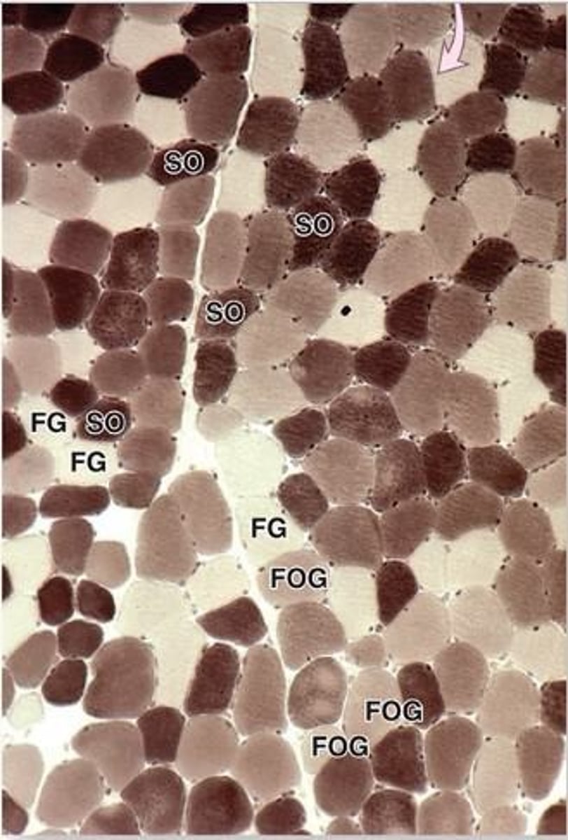 <p>Fatigue-resistant fibers with high mitochondria content.</p>