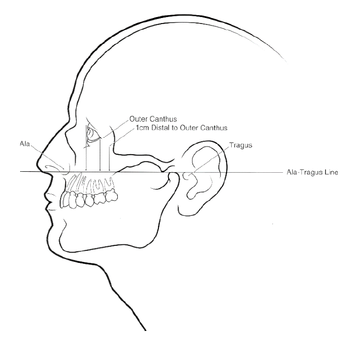<ul><li><p>central/laterals - side of nose</p></li><li><p>canine - side of nostril flap (ala of nose)</p></li><li><p>premolar - perpendicular line from pupil</p></li><li><p>molar - outer corner of eye</p></li></ul><p></p>
