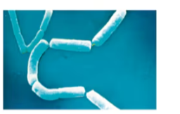 <p>chain-like rods</p>