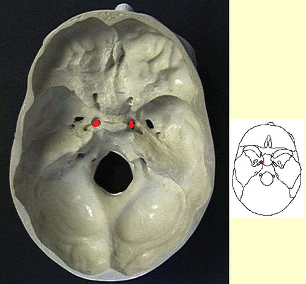 <p>oval shaped hole under foramen rotundum</p>