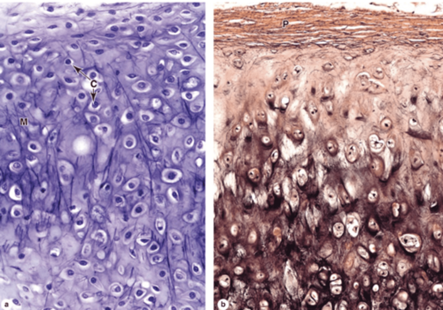 <p>What fibers form the meshwork in elastic cartilage ECM?</p>