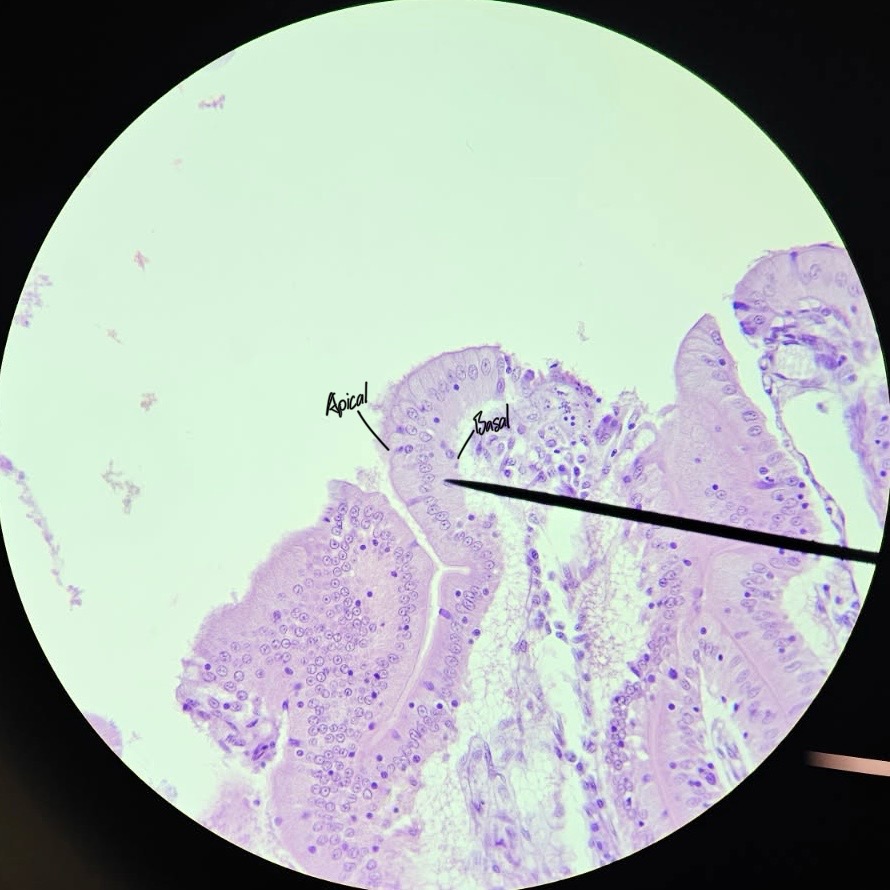 <p>Simple Columnar Epithelium</p>