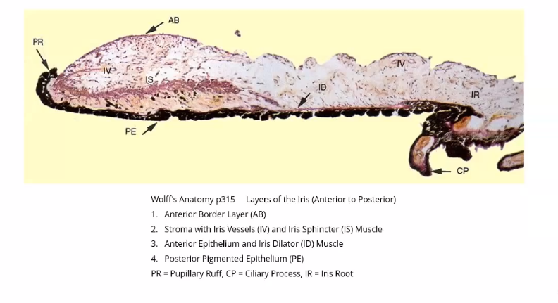 <p>blood vessels flowing through the muscle layers </p><p>iris regulates pupil size and keeps regulates light entering the eye </p><p>most anterior layer - anterior borfer layer </p><p>anterior epithelum- quite posterior </p>