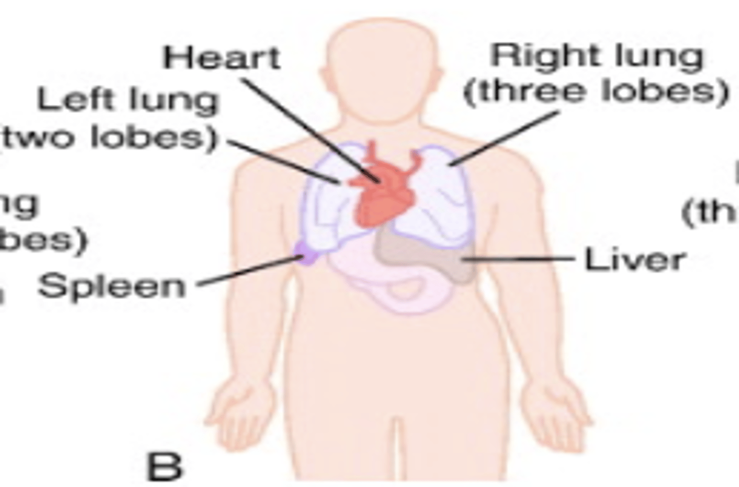 <p>reversed position of organs</p><p>(mirror image of situs solitus)</p>