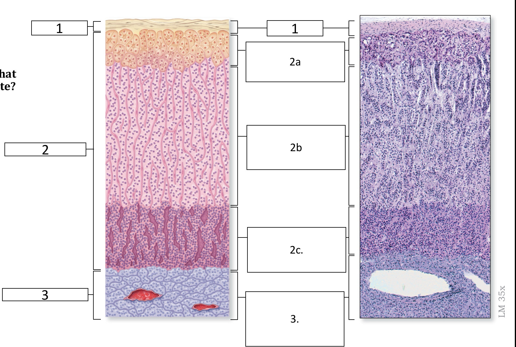 <p>Label 1, 2, and 3</p>