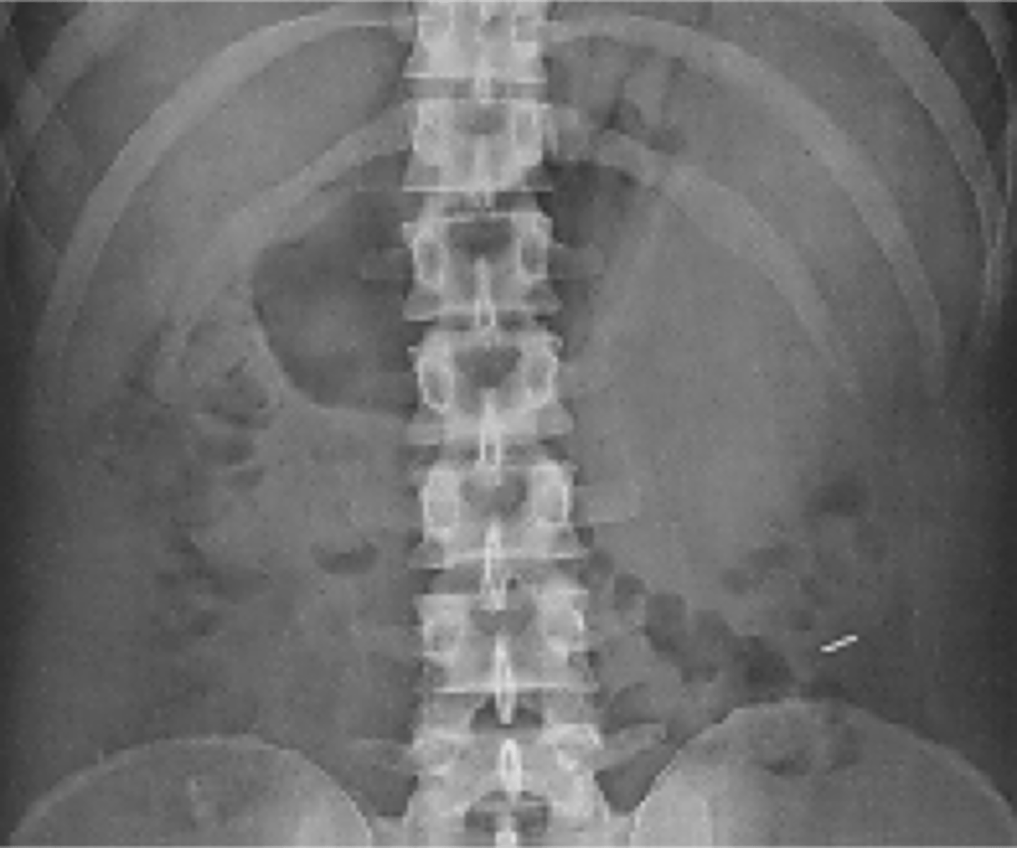 <p>no contrast</p><p>-skeletal</p>