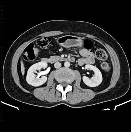 <p>CT Scan</p>