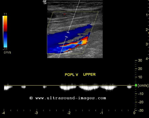 <p>This waveform indicates </p>