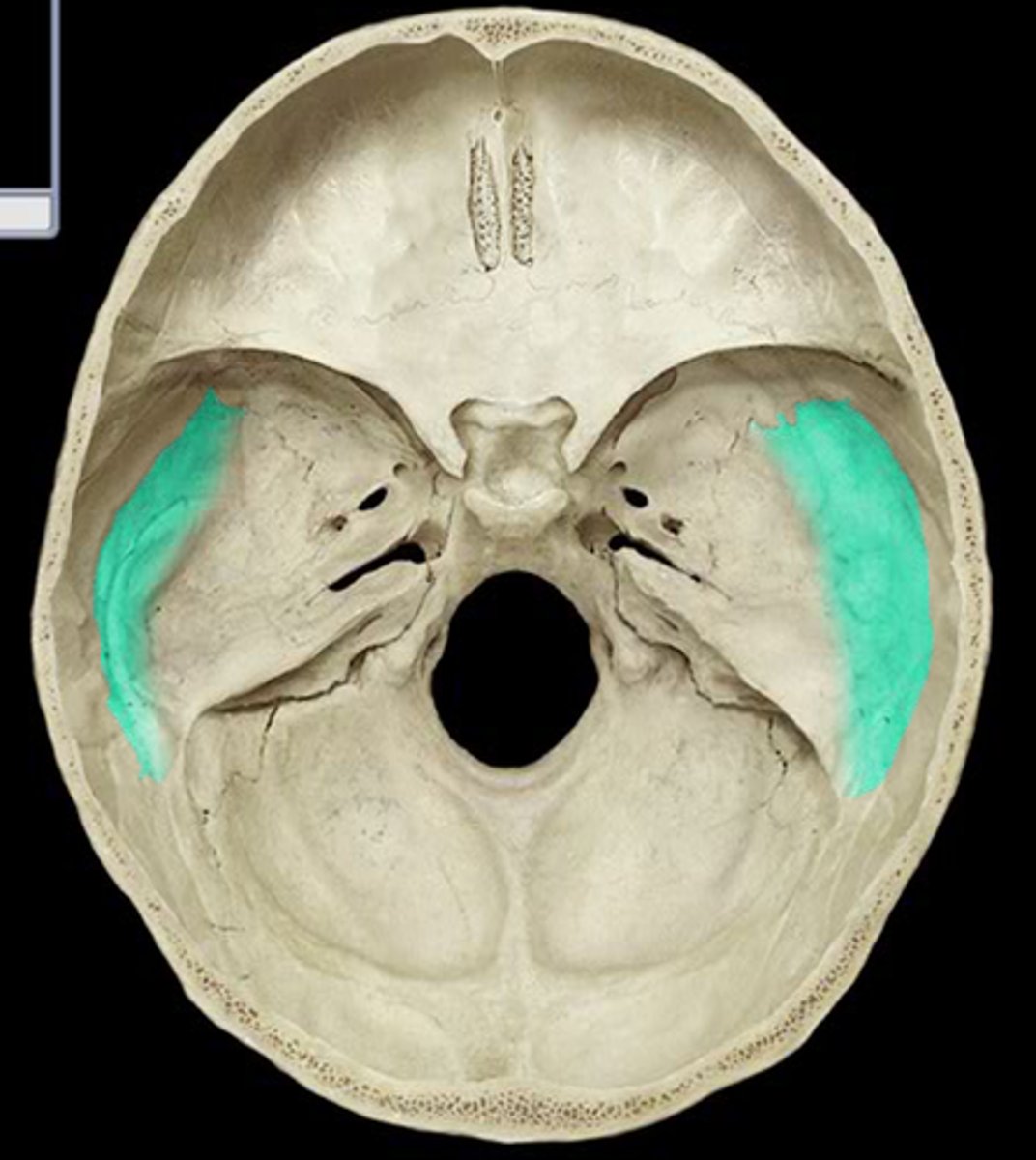 <p>The smooth part of the temporal bone through the inside</p>