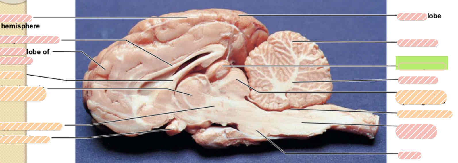 <p><span>Sheep brain</span></p>