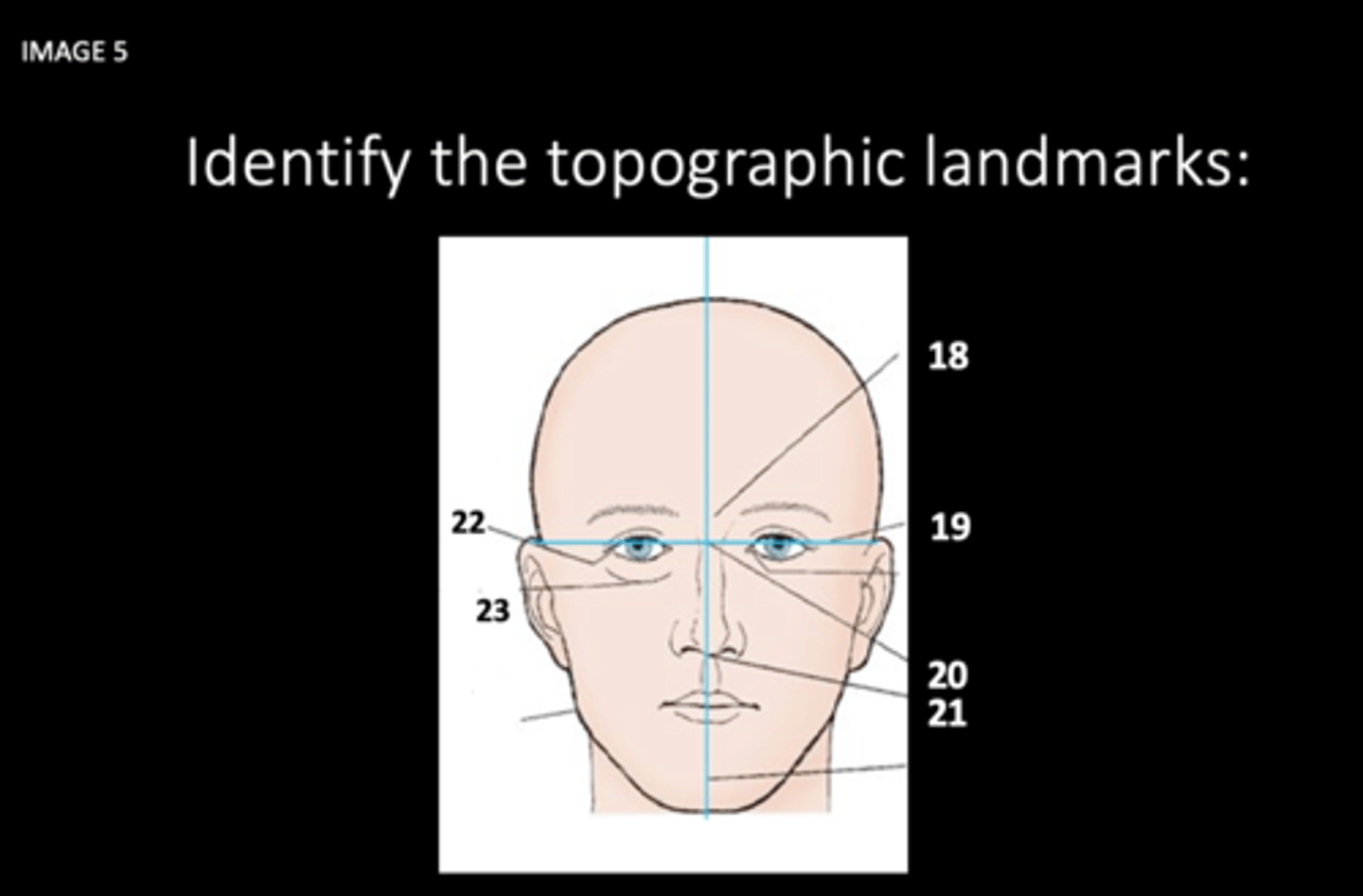 <p>Identify the topographic landmarks:</p><p>What is 18?</p>