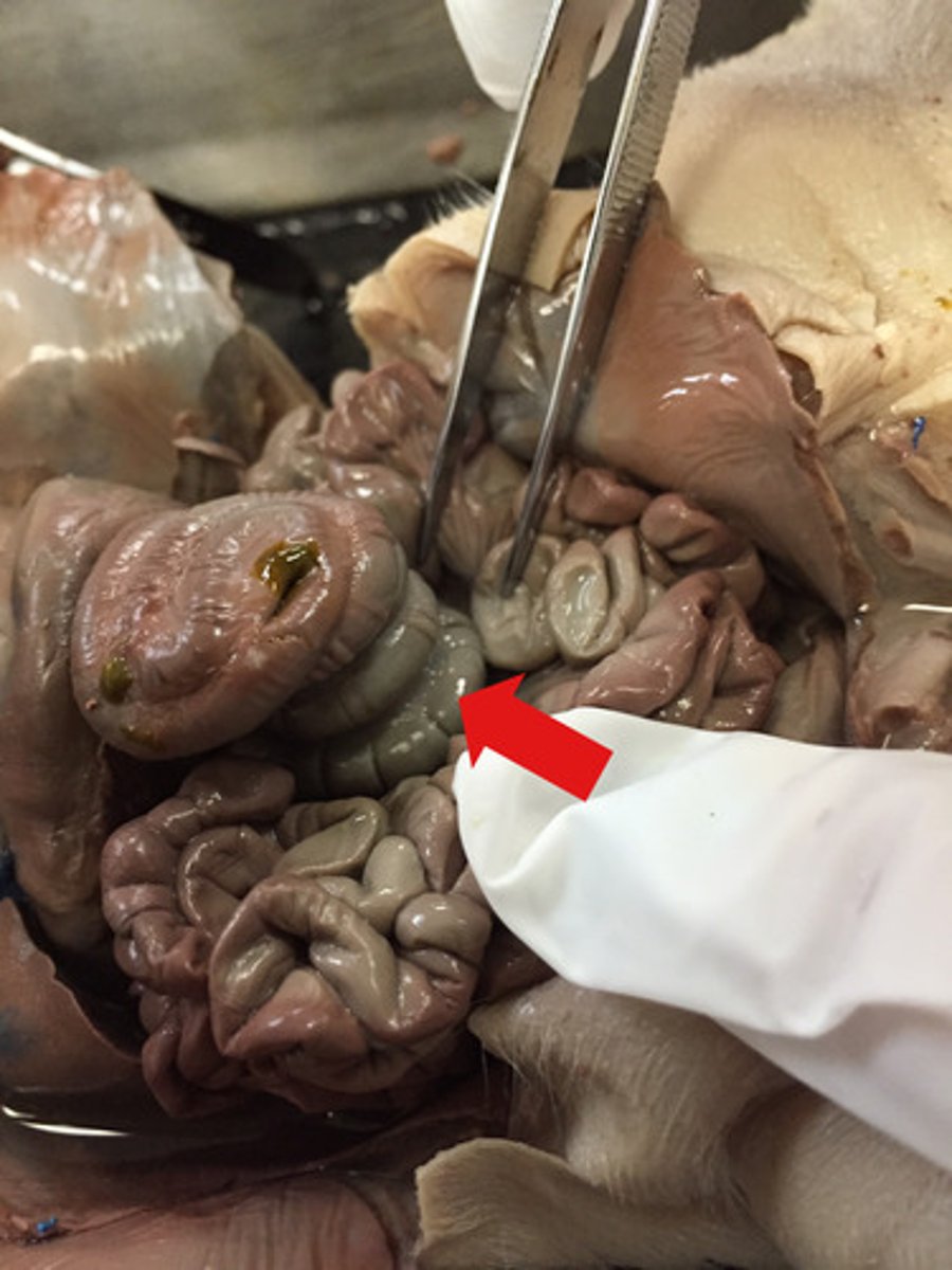 <p>-The small intestine toward the anus</p><p>-Located at the junction of the large intestine (colon) and the small intestine.</p><p>-Part of the Digestive System</p>