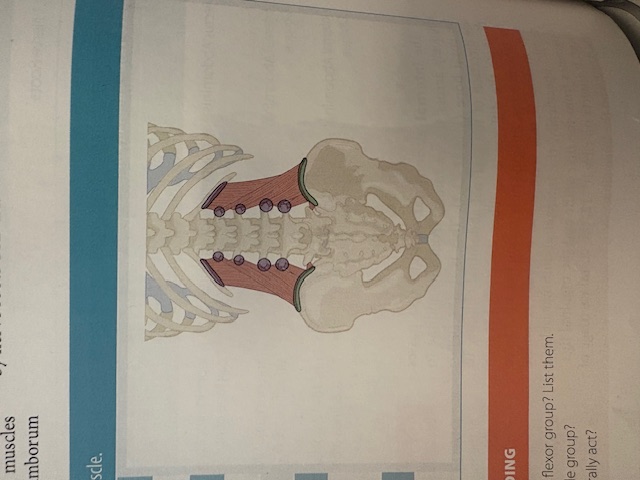 <p>Quadratus Lumborum</p>
