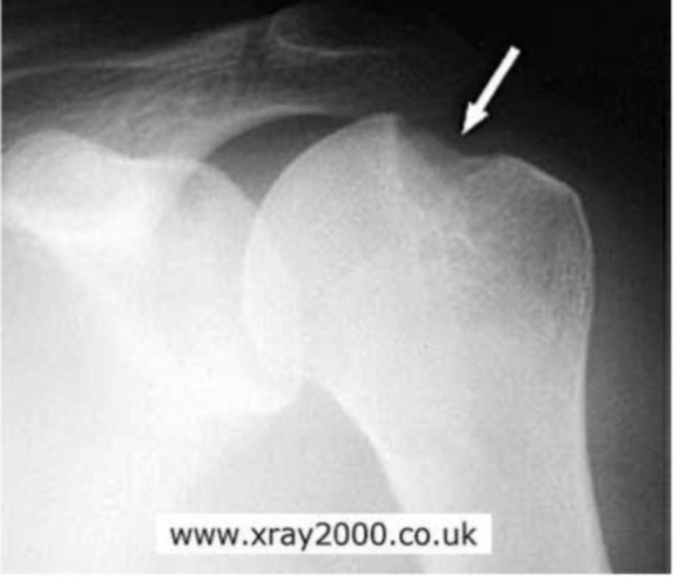 <p>What is the issue?</p>