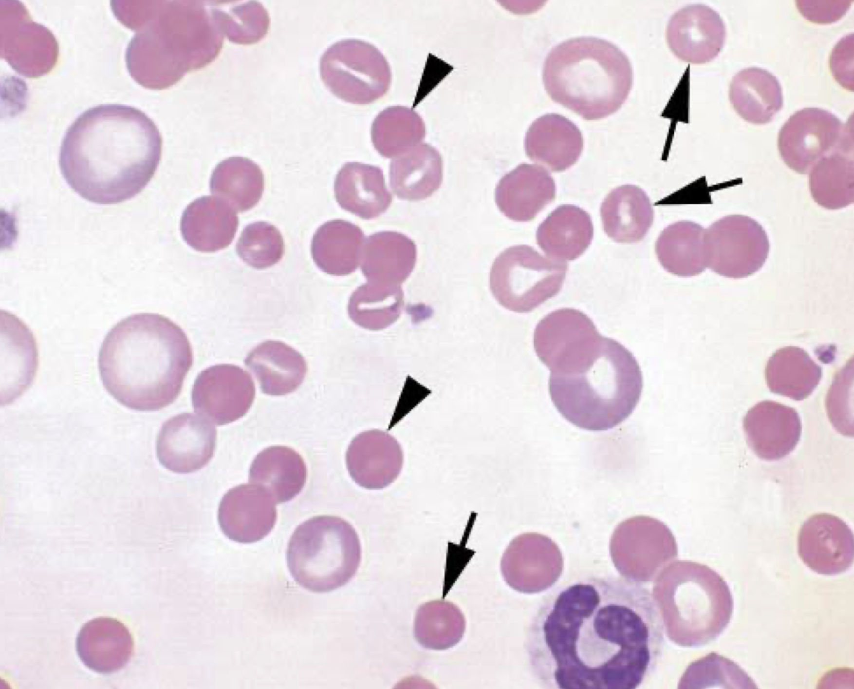 <p>what is the arrow pointing to in this image? arrow head? </p>