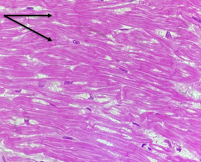 <p>What is this pointer pointing to?&nbsp;</p>