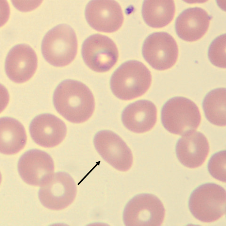 <p>What is the shape of this erythrocyte?</p>