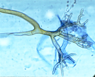 <p>Rhizopus </p>