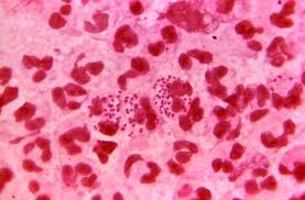 <p>what is the organism</p>