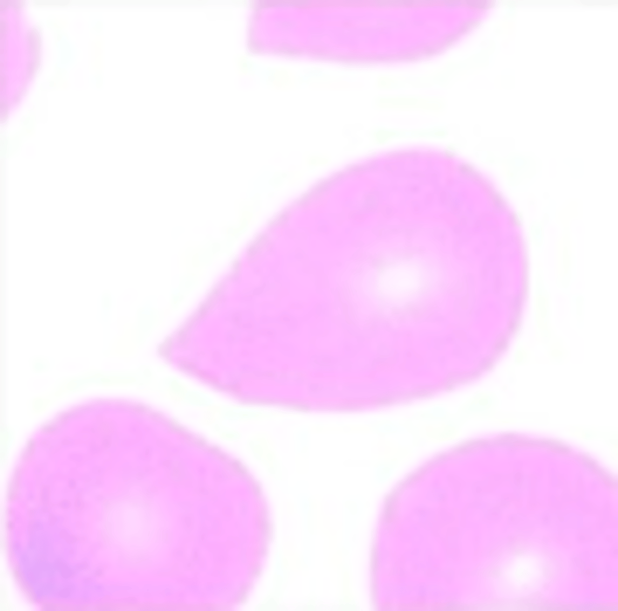 <p>What RBC morphology is this?</p>