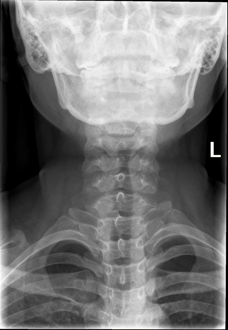 <p>To the center of the IR.</p>