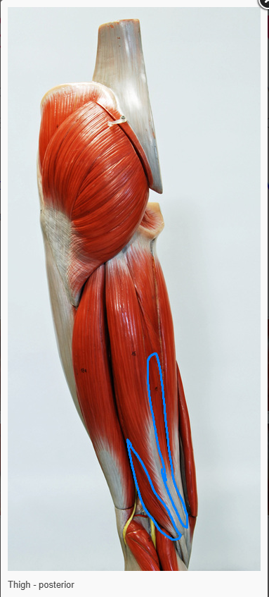 <p>What is the action of the muscle circled </p>