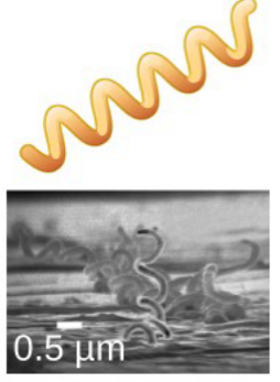 <p>What type of bacteria is this?</p>