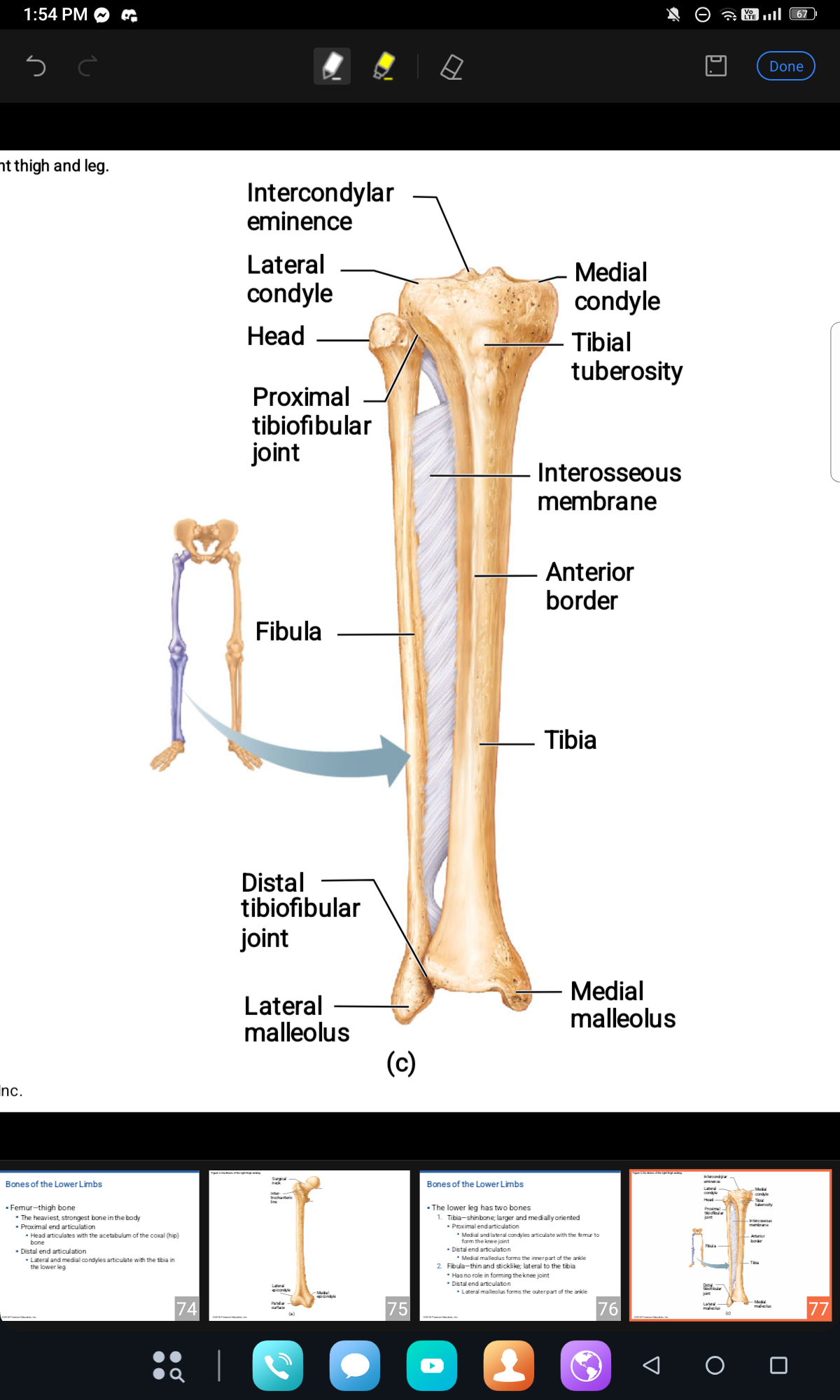 <p>Tibia, Fibula, Lateral Malleolus, Medial Malleolus </p>