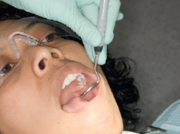 <p><strong>What is extraoral fulcurm?</strong></p>