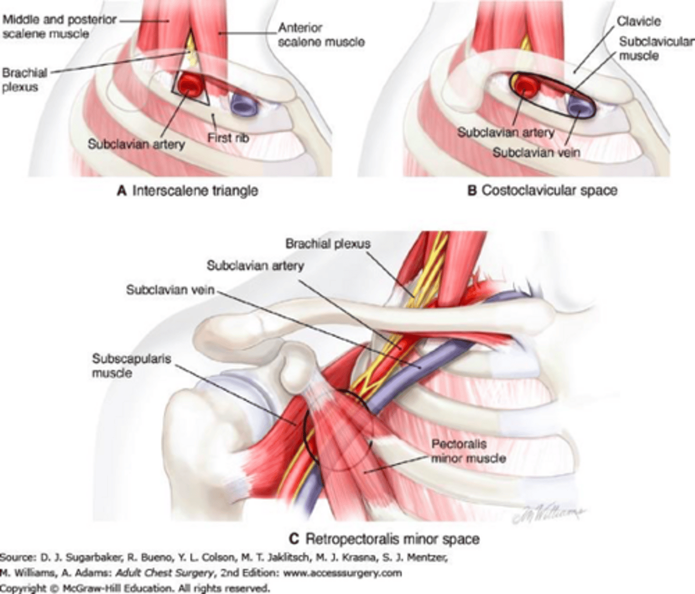 <p>•Pain, weakness, numbness&nbsp;and&nbsp;paresthesias over the trapezius, neck, chest, shoulder and/or arm</p><p>•Intermittent discoloration&nbsp;and&nbsp;swelling&nbsp;of the upper limb (venous involvement)</p><p>•Raynaud-type symptoms: coolness, pallor, erythema, symptoms associated with temperature change (arterial involvement)</p>
