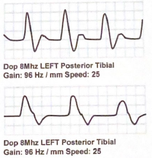 <p>describe the difference between these waveforms</p>