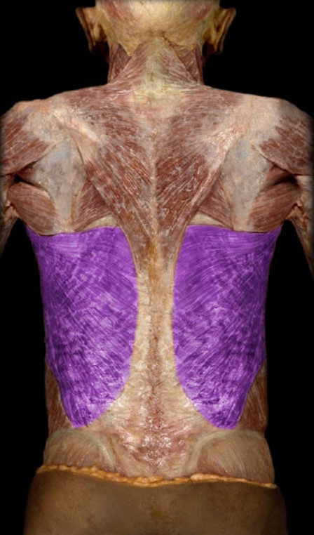 <p>Name the muscle highlighted (two words - all lowercase)</p>