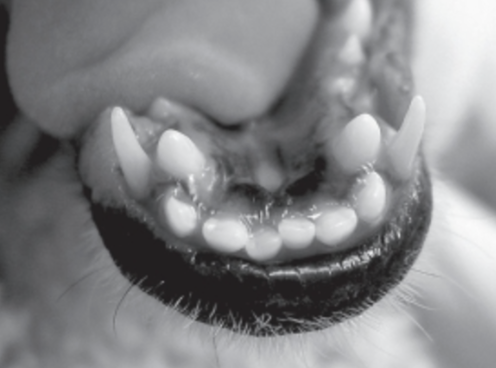 <p>Identify the two malocclusions present in this patient.</p>