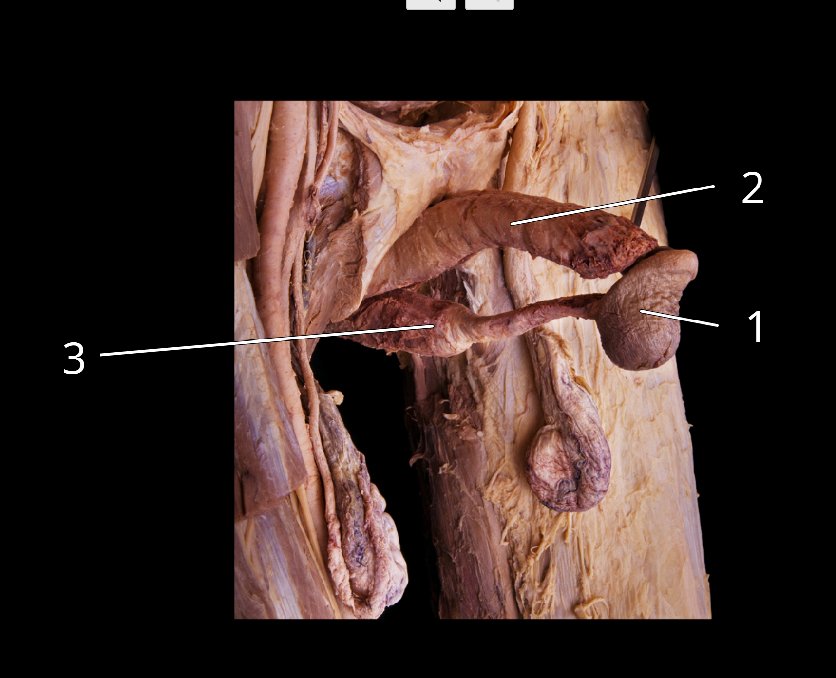<p>Structures of the penis </p>