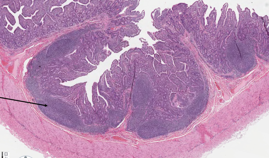<p>What is the structure marked by an arrow in a sheep ileum?</p>