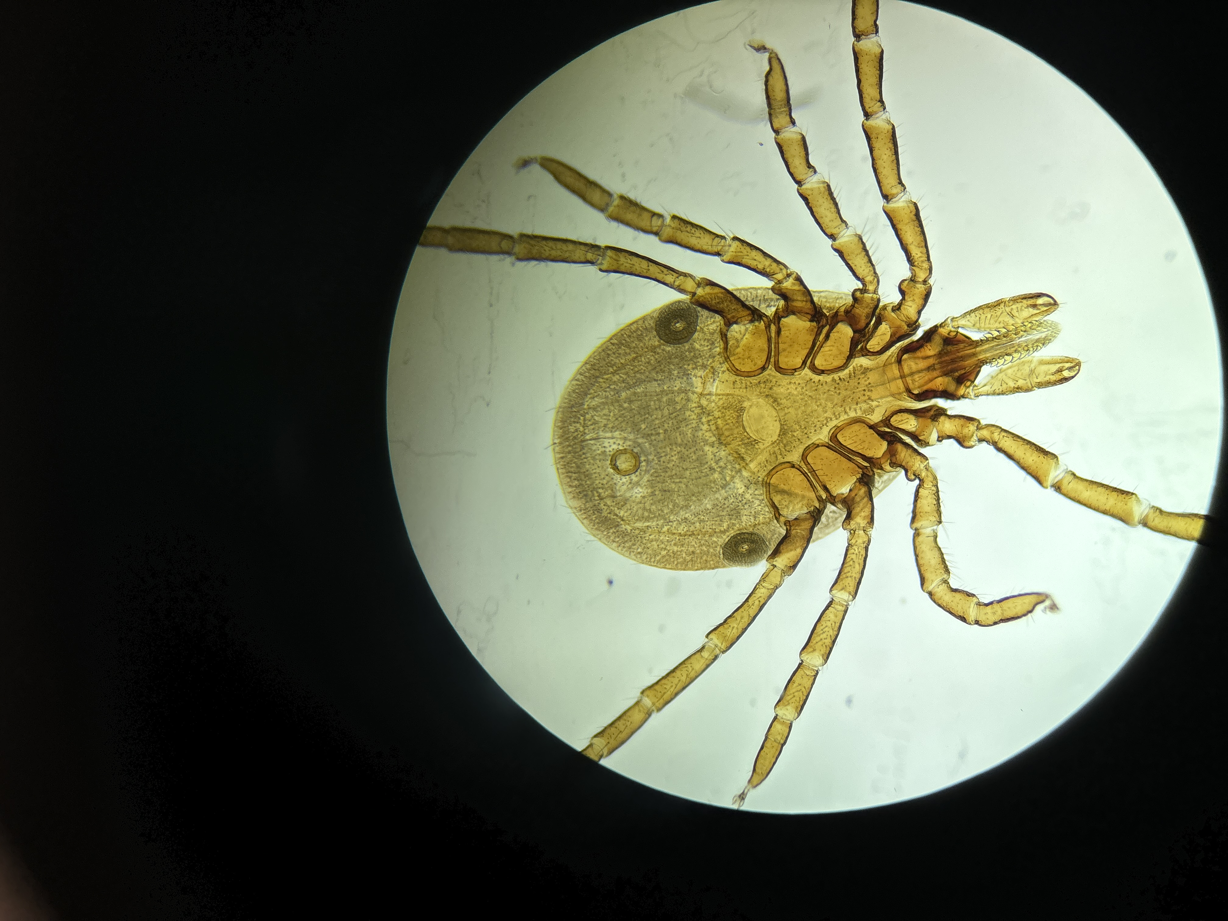 <p>Identify this Tick. (Common &amp; Genus)</p>