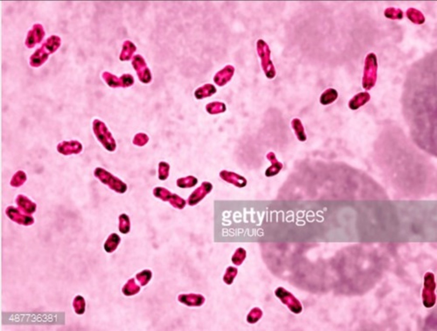 <p>Cause of the bubonic plague.</p><p>Gram negative coccobacillus.</p><p>Facultative anaerobe.</p><p>Transmitted by oriental rat flee.</p><p>Non motile.</p><p>Stick shapped bacteria with bipolar staining.</p><p>Safety pin appearance.</p>