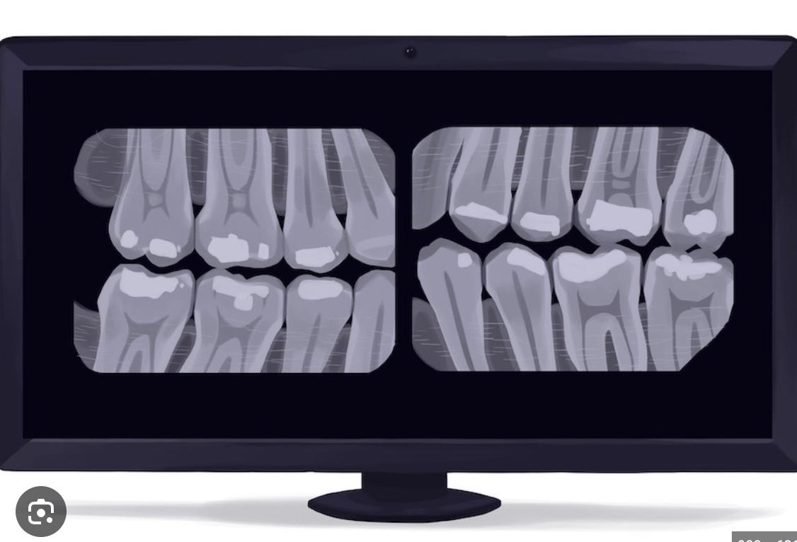 <p>what are bitewing xrays?</p>