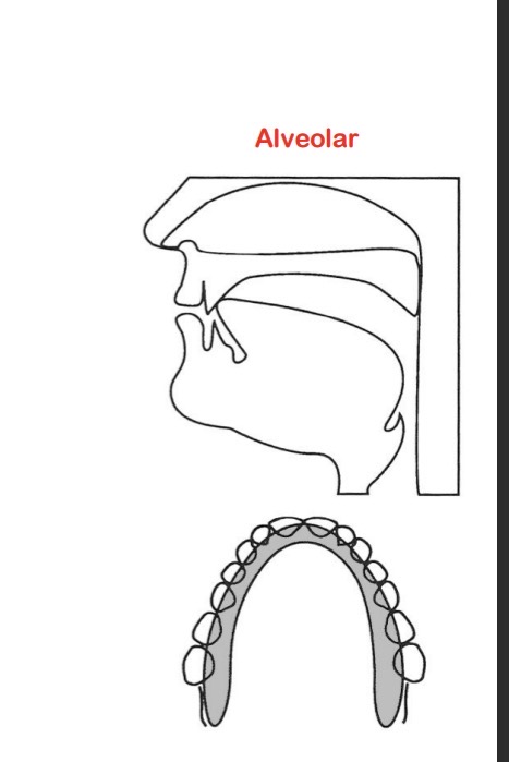 <p>/n/ - alveolar nazalisation</p>