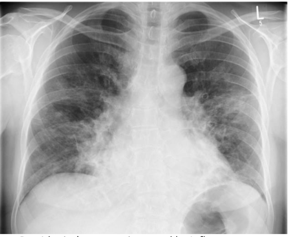 <p>What is this? and what causes it?</p>