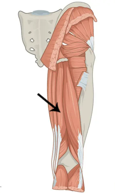 Identify what muscle this is 
