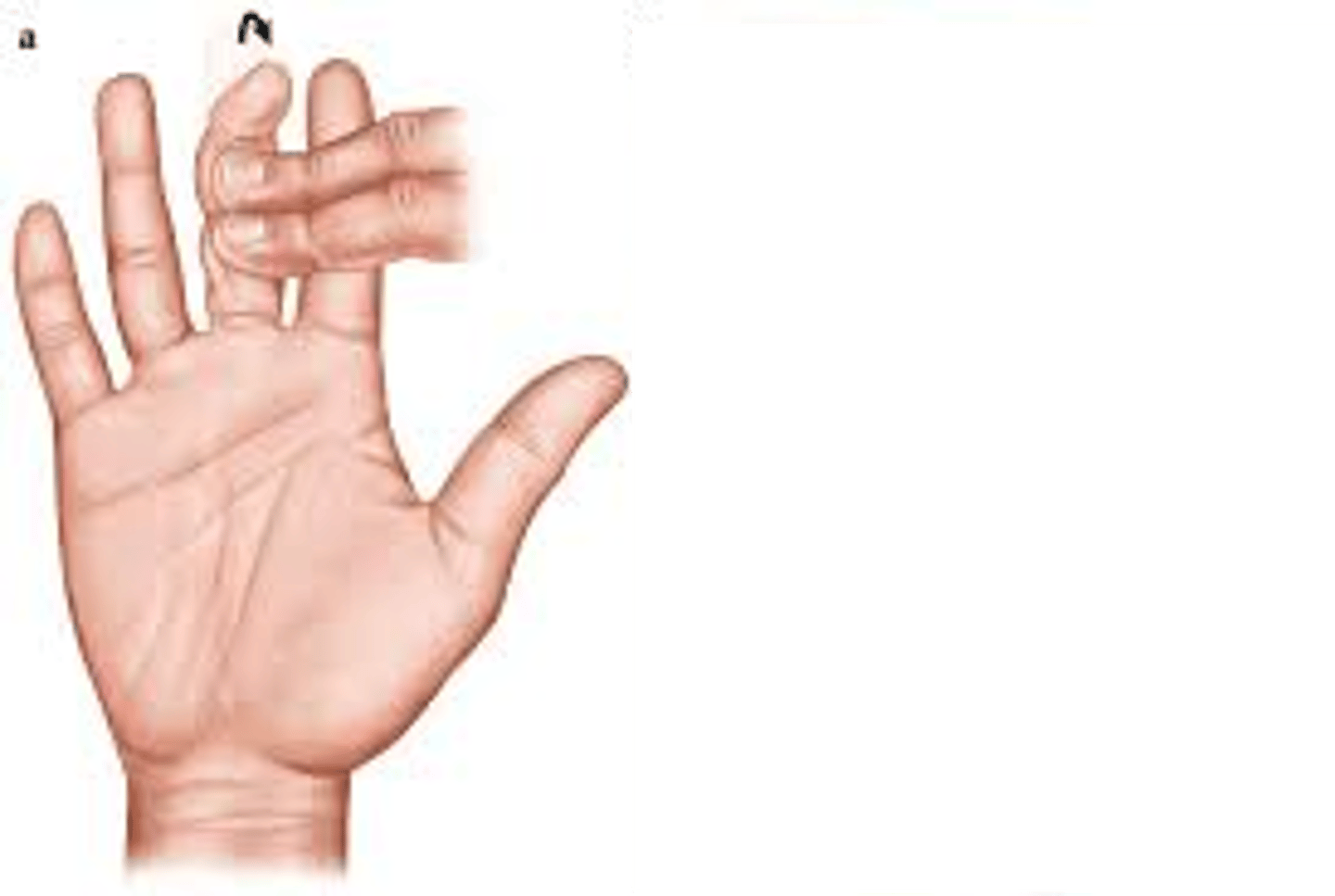 <p>Flexes DIP</p><p>The provider holds all fingers in extension, then asks the patient to bend only the fingertip joint.</p>