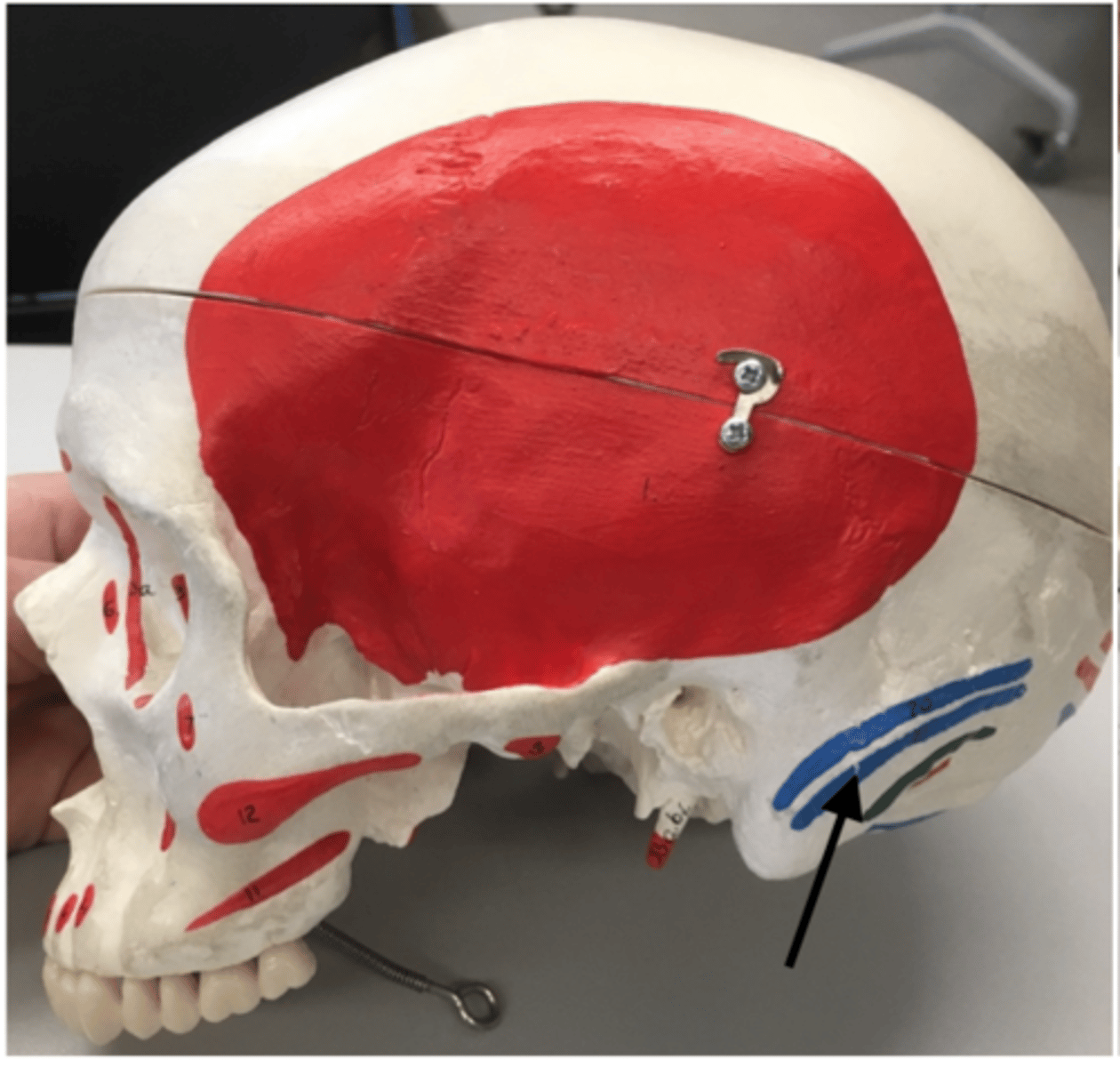 <p>21</p><p>I: Mastoid process, occipital bone</p>