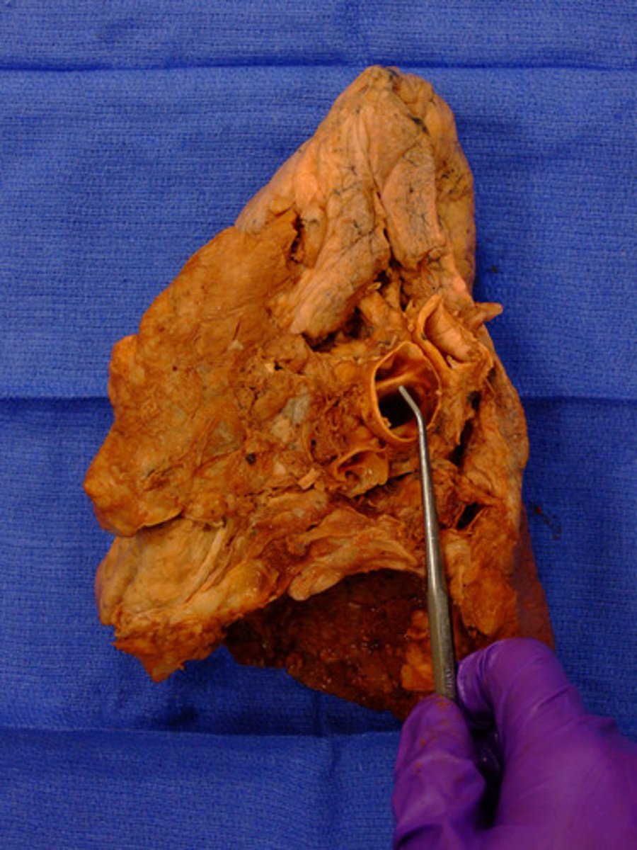 <p>Name the Artery</p>