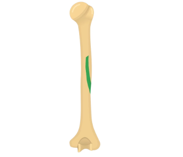 <p>name this bone or bone marking</p>